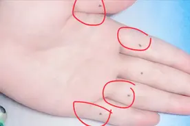 如果你的手指长痣，那么要恭喜你了，有数不尽的贵人才气