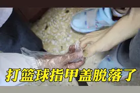 男子打篮球指甲盖和肉分离了，医生：没大问题，会长出新的指甲