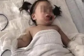 可怕的一幕，2岁女童拿铁钉子玩插线板遭电击，妈妈崩溃痛哭视频封面
