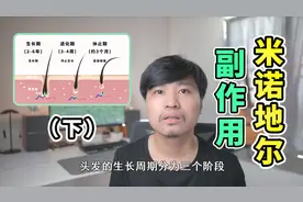 【生发挑战】使用落健米诺地尔长胡子为什么会出现狂脱发？（下）视频封面