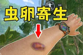 虫卵钻进身体，我用骨针刺破，结果病情更严重了【绿色地狱】