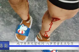 地下车库天窗破洞，男童玩耍坠落双腿被扎破，家长怒找物业讨说法视频封面