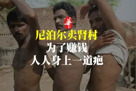尼泊尔“卖肾村”：穷人们以700美元高价出售，人人身上一道疤