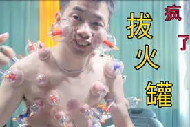 全身拔火罐是一种什么样的体验?连脸上都拔，太夸张了视频封面