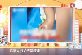 这种宠物你敢养吗?男孩网购5条竹叶青蛇,结果毒牙没拔反被咬中毒视频封面