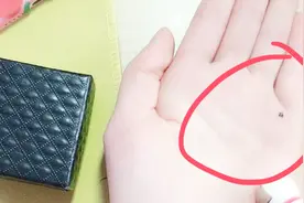 水星丘有痣的人是好还是坏？赶紧对照着看看吧，