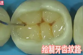 12000元补一颗牙，你见过吗？视频封面