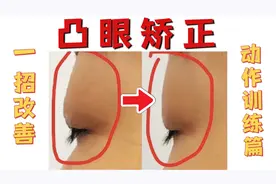 经常戴眼镜，眼球凸出？1个动作每天练习6min改善突眼视频封面