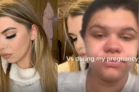 准妈妈怀孕变大鼻全身水肿至判若两人，网友：每天一个恐育小技巧视频封面