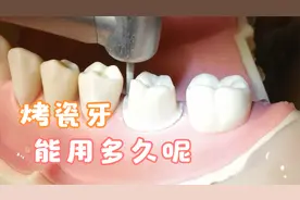 做烤瓷牙3D动画，烤瓷牙的使用寿命？烤瓷牙用了十几年要不要跟换