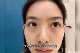 网曝孙一宁整容截图证据，双眼皮鼻子等多处微调，手术前后差距大视频封面