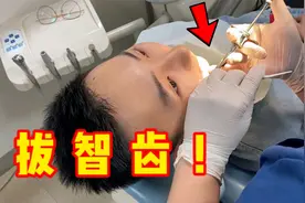 我长了4颗智齿，挑战全部拔掉！脸会不会肿成猪头？视频封面