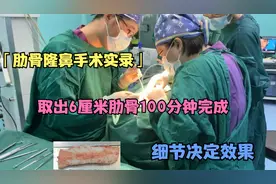 「肋骨隆鼻手术实录」，取出6厘米肋骨100分钟完成，细节决定效果