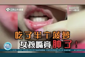 合肥一女生吃了半个菠萝，嘴巴竟肿胀出血！医生提醒注意这些细节视频封面
