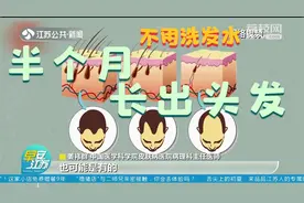男子秃顶半个月，不用洗发水半个月长出头发？专家给出解答！