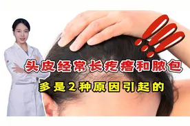 头皮经常长疙瘩和脓包？提醒：多是2种原因引起的，医生教你改善