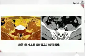 断层影像解剖学--六、盆部--6.2男性盆部与会阴