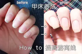 手指的甲床、游离线也能育成？爱咬指甲的朱一龙们有救了！