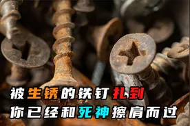 命大！被生锈的铁钉扎到不做处理，你已经和死神擦肩而过！