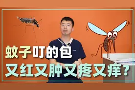 蚊子叮的包为什么又红又肿，又疼又痒？医生教你两招，有效止痒！