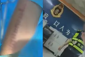 广东一货车超限点称重超载，司机请求复磅被拒，自残送医缝14针视频封面