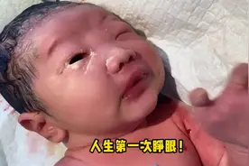 刚出生的宝宝眼睛粘住睁不开，护士直接用手掰开！