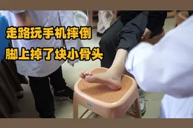 姑娘走路玩手机摔倒，脚上掉了一块小骨头！