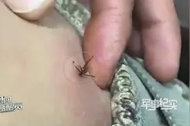 知识贴：蜱虫钻肉怎么办？边防官兵这样处理视频封面