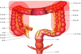 什么是结肠，它的功能是什么？结肠癌确诊的金标准是什么？视频封面