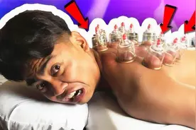 老外体验中国拔火罐，疼到嗷嗷大叫，全程笑到停不下来视频封面