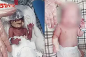 出生时仅22周6天 四川胎龄最小超早产儿出院，取名“恩恩”视频封面