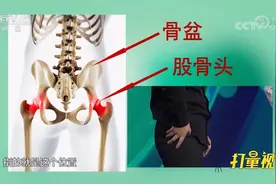股骨头究竟在哪，它的作用是什么？专家进行讲解|职场健康课