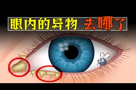 飞进眼睛的异物，最后都去哪了？视频封面