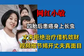 网红小敏患癌溃烂生虫，丈夫拒绝治疗借机敛财，意外暴露真实人品视频封面