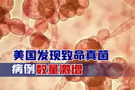 出事了，美国发现致命真菌，病例数量激增，大批感染者90天内死亡视频封面