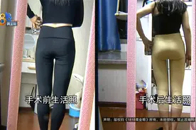 “梨形身材”想瘦腿，术后趴睡半个月效果没达到预期？视频封面