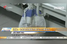 江门：七旬老伯膀胱内取出103颗结石视频封面