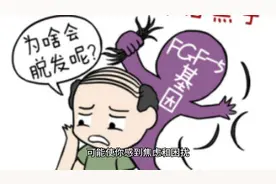 脱发不再为难：如何正确使用米诺地尔