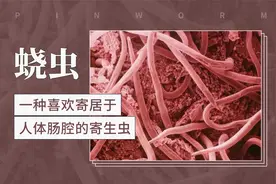 蛲虫——一种喜欢寄居于人体肠腔的寄生虫