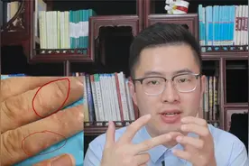 手上起小水泡，季节交替时反复发作？医生教你三招正确治疗汗疱疹视频封面