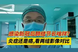 新冠后的肺结节长啥样？炎症和肺癌有何不同？通过两个病例告诉你视频封面