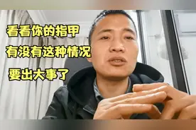 看你的指甲有没有这样的要出大事了#健康#健康预防#