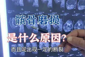 韧带损伤继发髌骨磨损导致产生疼痛，肖医生查体阅片分析病情视频封面