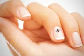 指甲下面出现黑斑怎么办