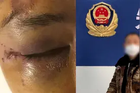 缅北逃亡归来男子亲述惊魂628天：他们下死手打，用枪往身上砸视频封面