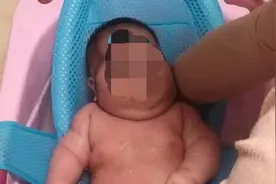 青岛大头娃娃后续：孩子身上爆皮，家长或起诉厂家视频封面