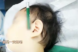 1岁多女童一声惨叫后，12cm长铅笔竟戳进脸，背后原因家长该看看视频封面