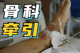 用钢针穿过骨头？3分钟了解骨科牵引术！