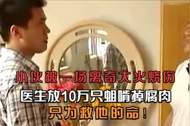 小伙被一场离奇大火烧伤，医生放10万只蛆啃掉腐肉，只为救他的命