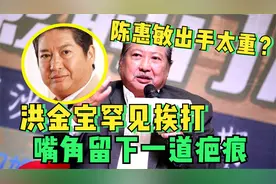 洪金宝嘴角的疤哪来的？传说惹恼陈惠敏，洪金宝至今不愿提起视频封面